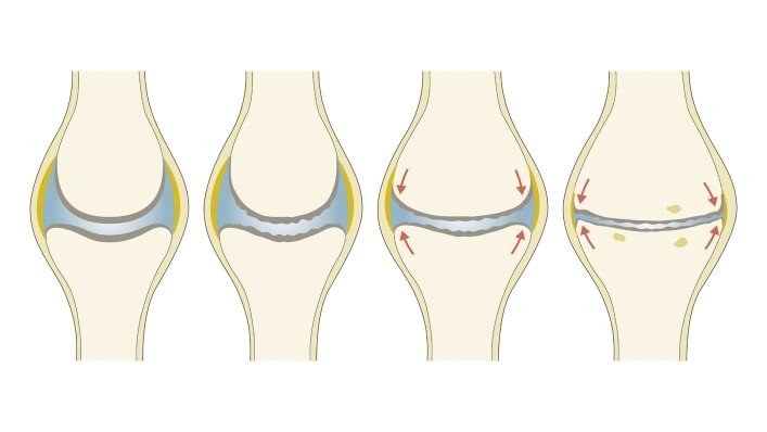 download spinal cord injuries