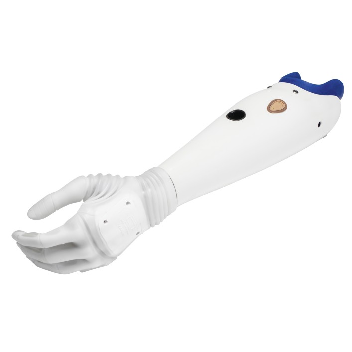 Axon-Bus prosthetic system with Michelangelo hand and forearm socket.