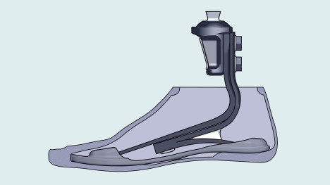 Drawing of a Triton prosthetic foot inside the footshell