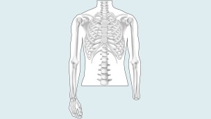 Drawing of the amputation level: wrist disarticulation