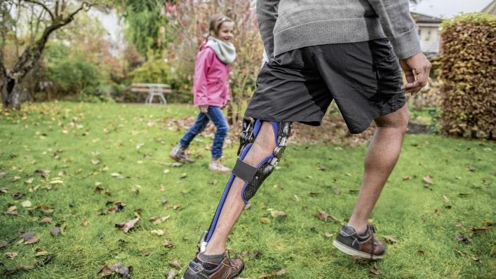 Melvin wears his computer-controlled C-Brace® KAFO. He is playing football with his niece.