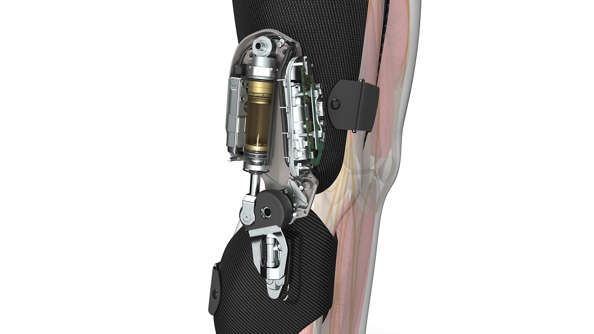 How does the C-Brace ® work? 