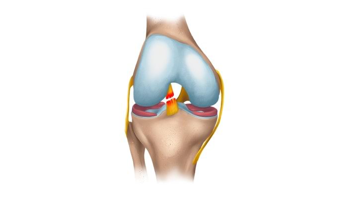 Clinical picture