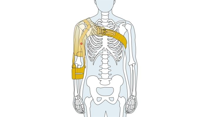 Skeleton after a stroke with the Omo Neurexa plus