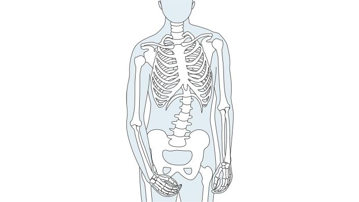 Skeleton after a stroke