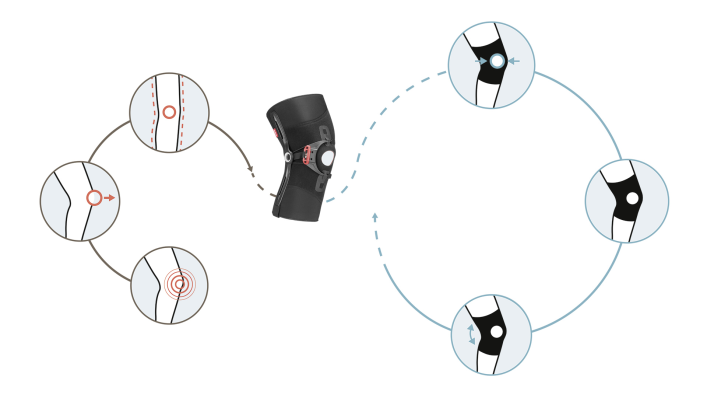 Vicious cycle of knee pain 