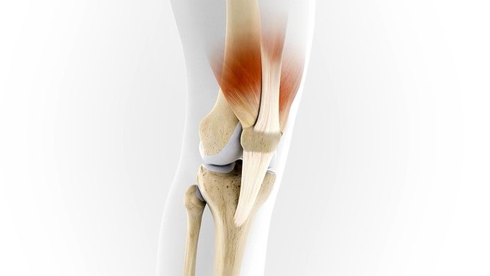 The mode of action of the Patella Pro is demonstrated