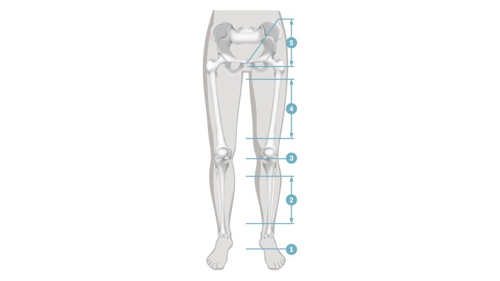 Eine anatomische Zeichnung mit Darstellung der unterschiedlichen Amputationshöhen am Bein.