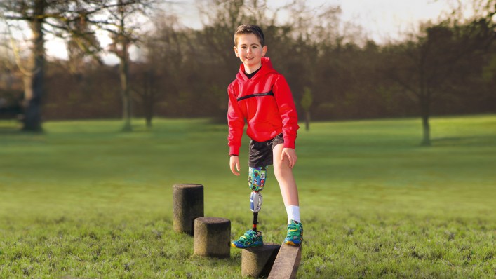 Auf dem Spielplatz: Kleiner Junge balanciert geschickt auf zwei Holzplanken unter voller Belastung des Prothesenbeins.