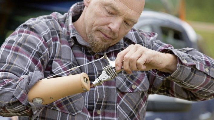 Das Wechseln eines Hooks an der Body-Powered Armprothese