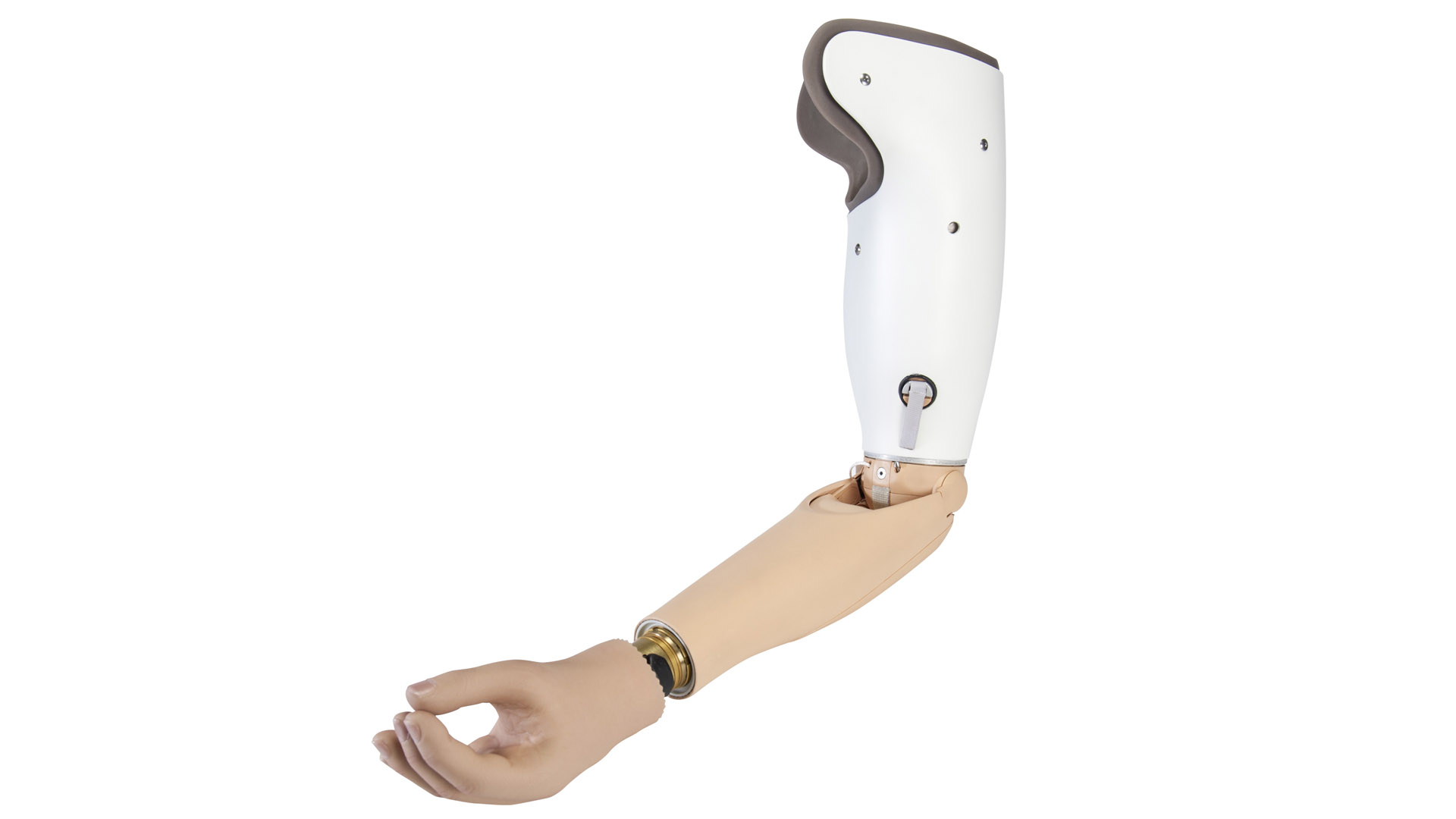 Transhumeral prosthesis with DynamicArm, MyoWrist and MyoHand