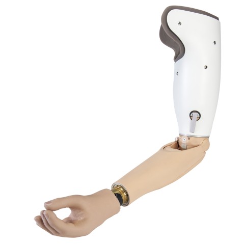 Transhumeral prosthesis with DynamicArm, MyoWrist and MyoHand