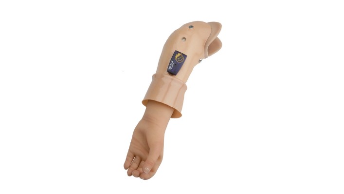 Armprothesensystem bestehend aus MyolinoWrist Handgelenk, Akkumulator und Steuerungseinheit 