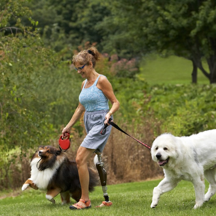 Lisa with C-Leg prosthesis taking her dogs for a walk.